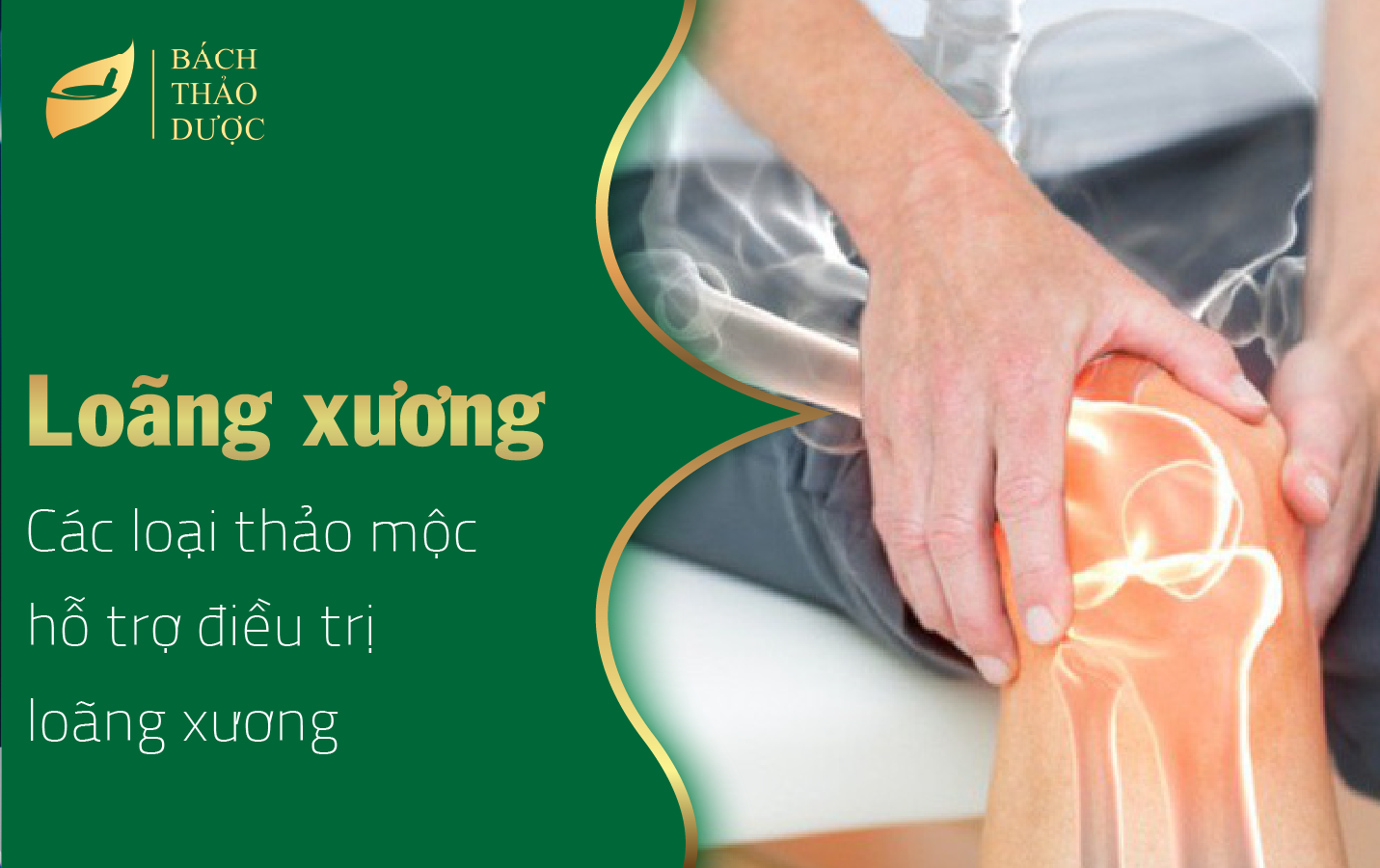 Các loại thảo mộc hỗ trợ điều trị loãng xương