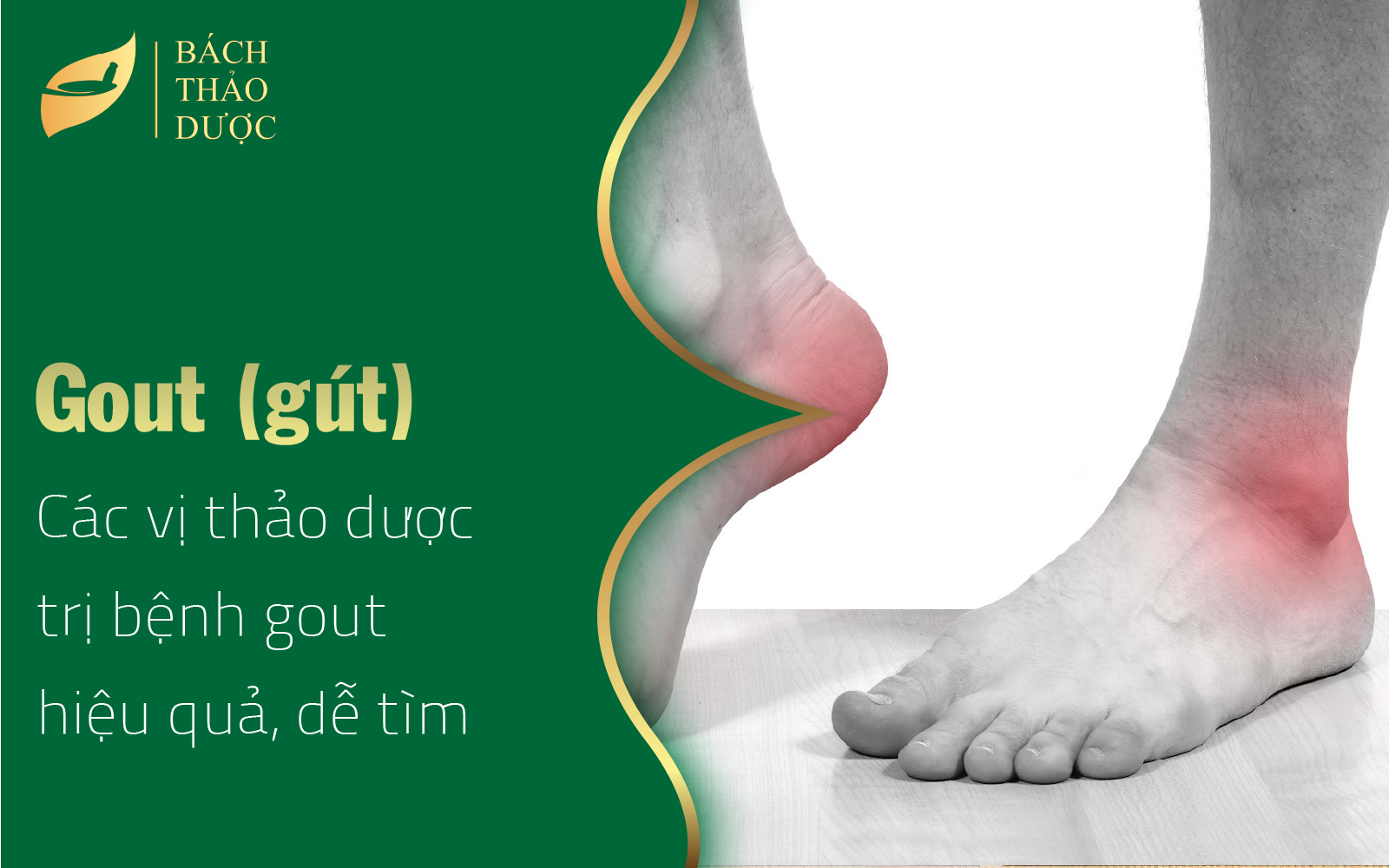 Các vị thảo dược trị bệnh gout hiệu quả, dễ tìm