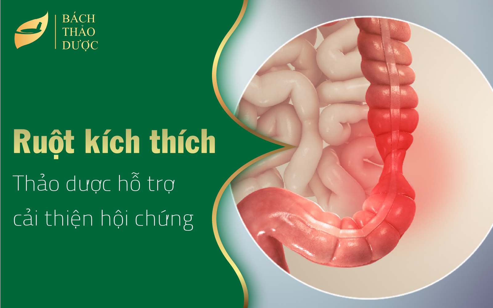 Thảo dược hỗ trợ cải thiện hội chứng ruột kích thích