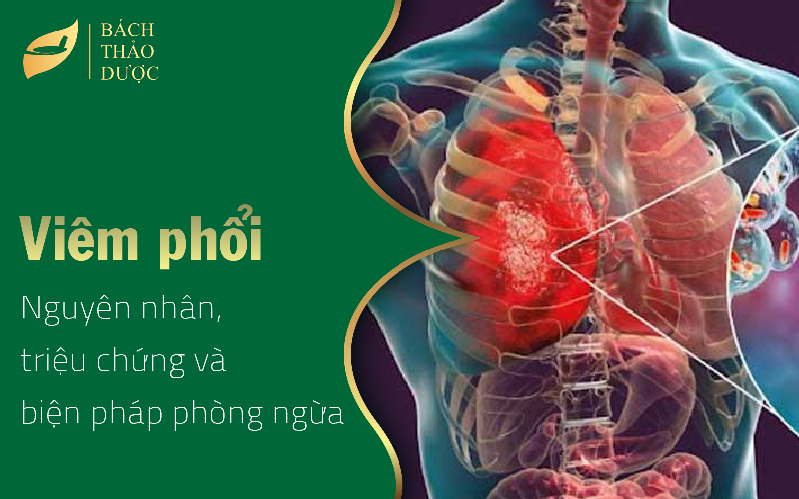 Viêm phổi nguyên nhân, triệu chứng và biện pháp phòng ngừa