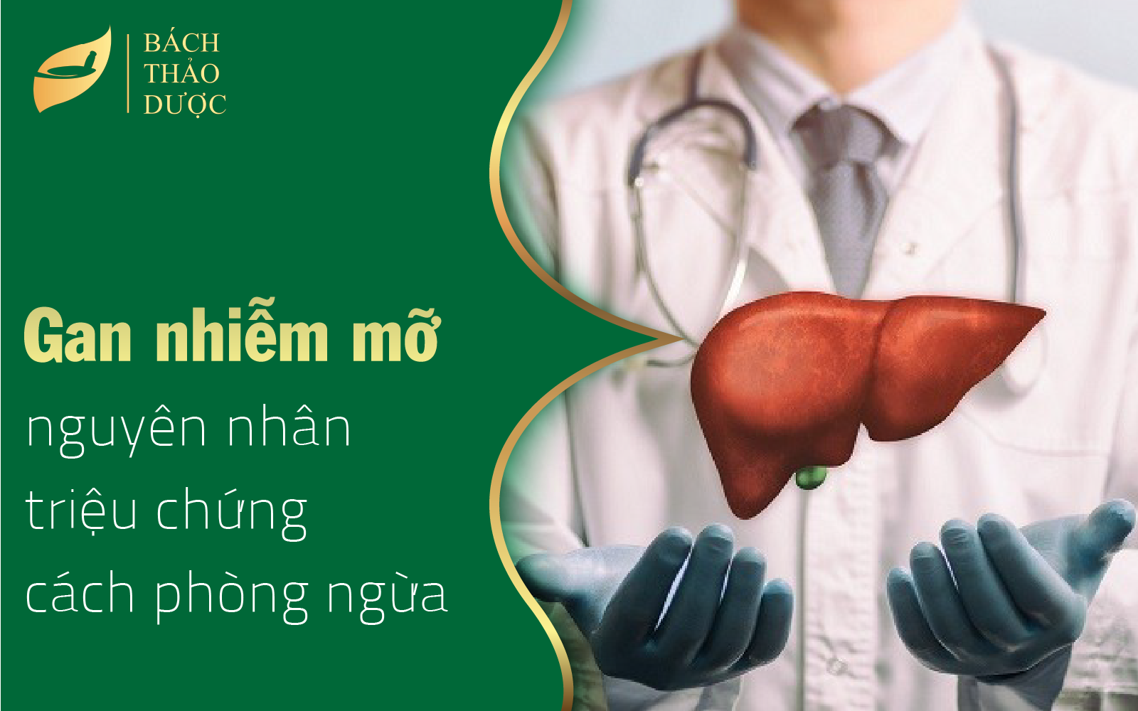 Gan nhiễm mỡ - nguyên nhân, triệu chứng và cách phòng ngừa