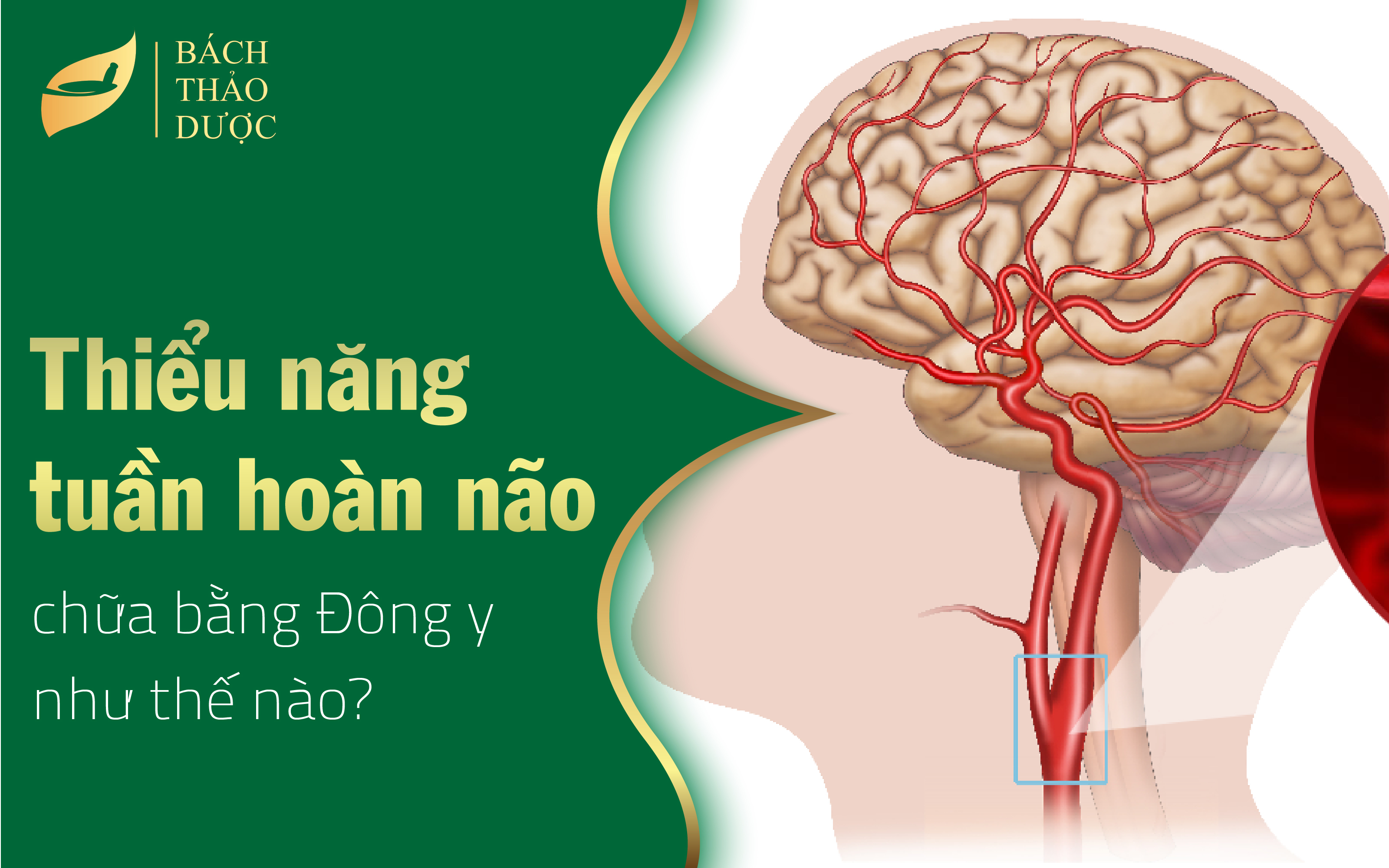 Chữa thiểu năng tuần hoàn não bằng đông y