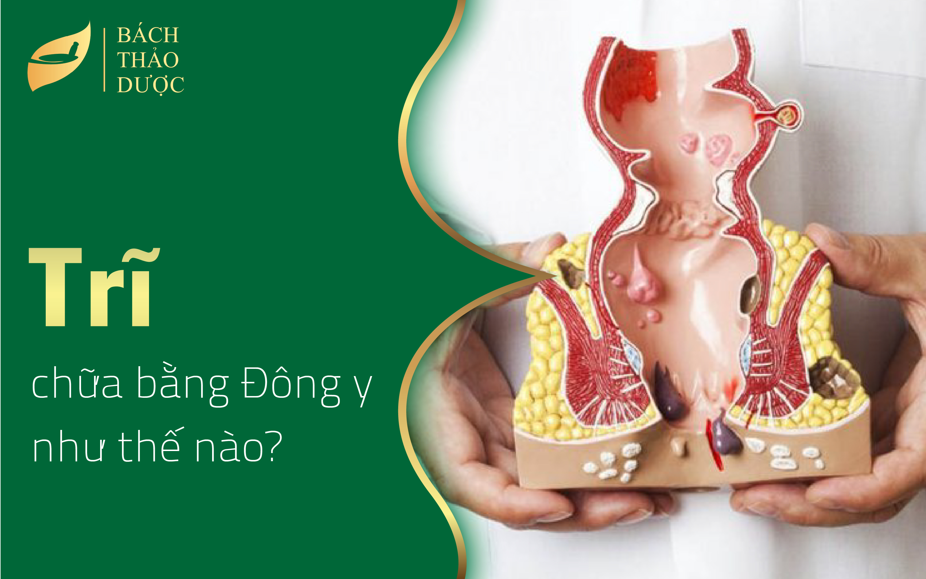 Bài thuốc Đông y chữa bệnh trĩ hiệu quả và an toàn