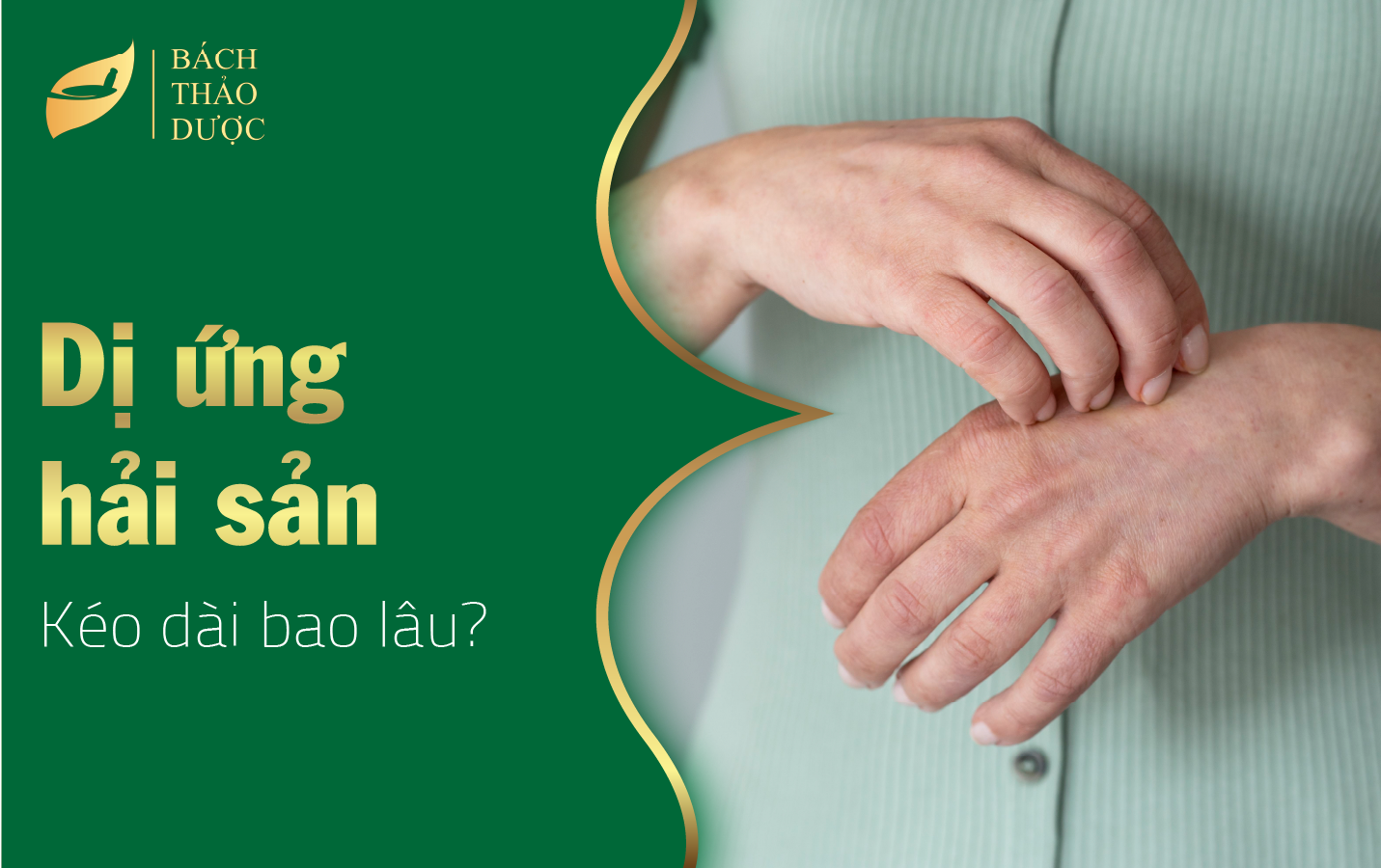 Giải đáp thắc mắc dị ứng hải sản kéo dài bao lâu​?